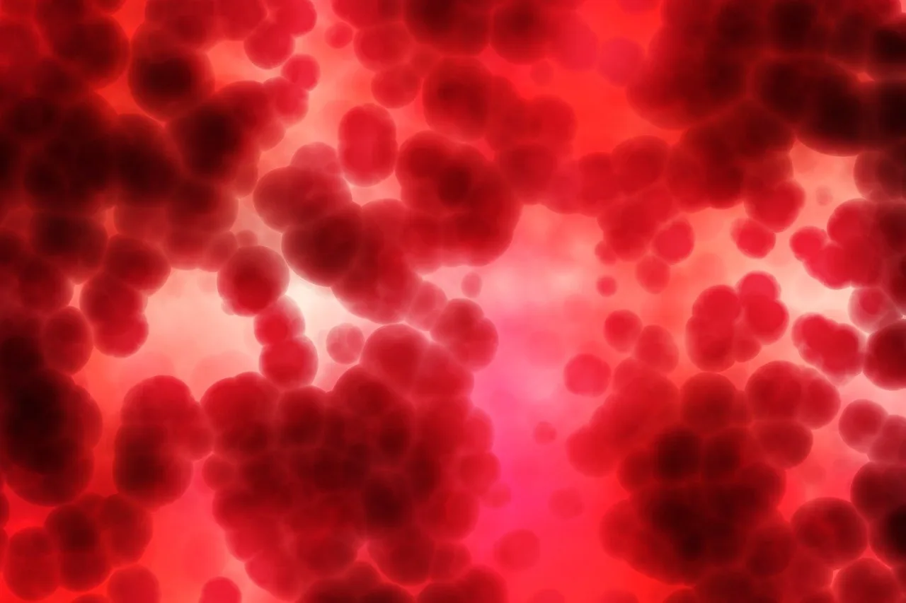 Hemochromatosis: Iron Overload Signs, Organ Harm, Phlebotomy Therapy